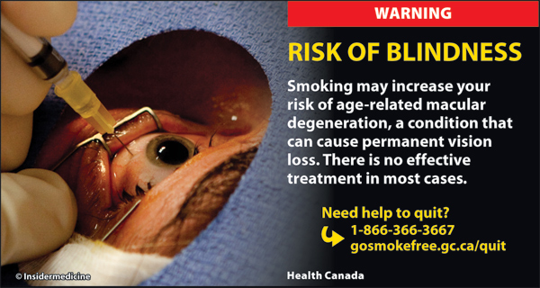 Canada 2012 Health Effects eye - vision loss, gross - cigars eng